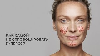 Дарья Орлова Как самой не спровоцировать купероз [upl. by Orapma]