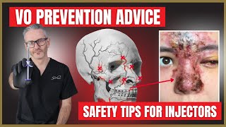 Vascular Occlusion amp Necrosis Prevention  Dermal Filler Safety Advice for Injectors [upl. by Eiramalegna]