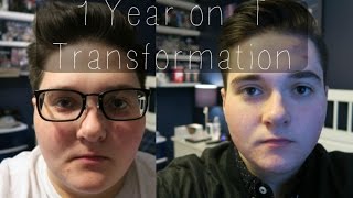 FTM TRANSGENDER 1 Year on Testosterone and Weight loss Transformation [upl. by Elizabet]