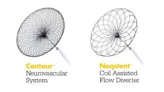 Stryker completes acquisition of Cerus Endovascular [upl. by Puduns]