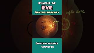 Fundus of an EYE explained simply in less than 60 seconds  USMLE NEET PG NCLEX [upl. by Eldnek761]