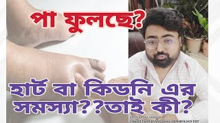 পা ফুলে যাওয়ার কারণ  Causes for swollen legs or Edema in Bengali by Dr sourav sarkarBONGDOC [upl. by Rickard470]