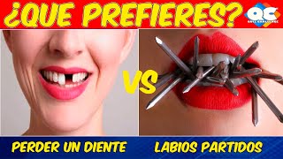 ¿QUÉ PREFIERES ¡ 35 DESICIONES EXTREMAS QUIZ CHALLENGE YT [upl. by Sirrep]