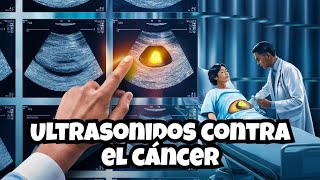 Ultrasonido El Futuro de la Detección del Cáncer [upl. by Aerdnahc]