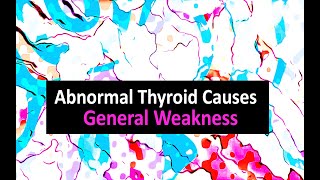 Abnormal Thyroid Causes General Weakness [upl. by Rexanna]