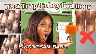 WHY KOJIC SAN SOAP IS NOT WORKING FOR YOU  HOW TO SPOT THE FAKE  Do’s amp Don’t [upl. by Irik]