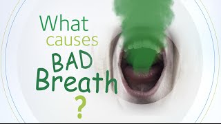 What Causes Bad Breath [upl. by Aneehsar]