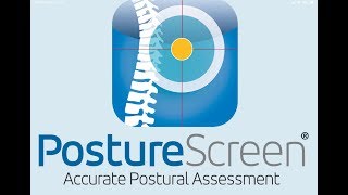 Advanced 4 View  Posture Assessment with PostureScreen [upl. by Cowan]