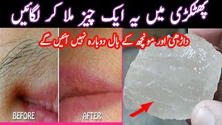 Unwanted facial hair removal home remedies by hadiya cooking and tips best hair removal cream [upl. by Nomyaw497]