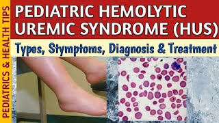 Hemolytic Uremic Syndrome HUS Symptoms Diagnosis amp Treatment In Children [upl. by Acinorav]