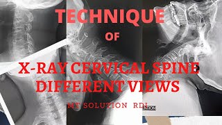 Xray cervical spine different views Ep06 বাংলা টিউটোরিয়াল [upl. by Nolitta70]