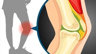 Sliding filament theory in muscle contraction  Wellcome [upl. by Curt564]