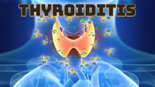 Thyroiditis updated 2023  CRASH Medical Review Series [upl. by Jaela]