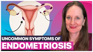 Endometriosis Symptoms The Hidden Signs You Need to Know Besides Painful Periods [upl. by Akers]