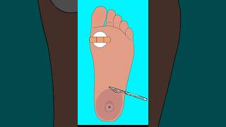 ASMR treatment foot injured asmrvideo animation animation satisfying [upl. by Louise]