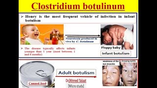 Clostridium botulinum Botulism disease quotMedical microbiology [upl. by Googins790]