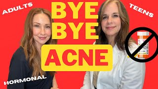 BYE BYE ACNE Adult Hormonal even Teens [upl. by Ylra916]