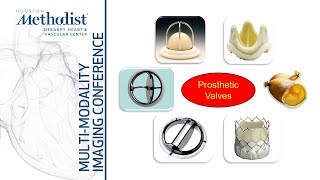 Evaluation of Prosthetic Heart Valves with EchoDoppler Role of CTMRI Zoghbi Chang Shah5322 [upl. by Anairo]