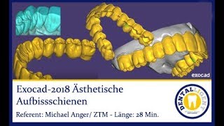 EXOCAD 2018  Ästhetische Aufbissschienen by Michael Anger [upl. by Esenej]