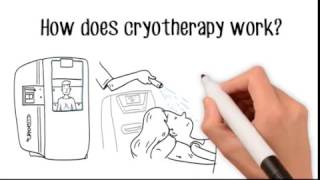 What is Cryotherapy  Cryotherapy Whiteboard Video [upl. by Afatsum]