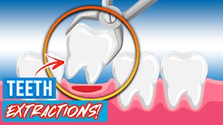 Tooth Extractions For Braces  Why Do Orthodontists Extract Teeth [upl. by Hellene672]