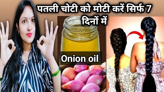 7 Days Hair Growth Challenge  MAKE ONION HAIR OIL for faster hair growth and stop hair fall [upl. by Nnoved]