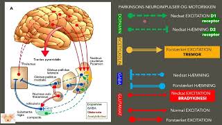 Challenges with Parkinsons disease [upl. by Perren]