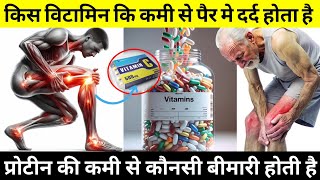 किस विटामिन कि कमी से जोड़ो में दर्द होता है  Vitamin ki Kami se Hone Wale Rog [upl. by Amalburga]