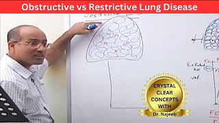 Obstructive vs Restrictive Lung Disease  Pulmonary Function Test🫁 [upl. by Sinne]