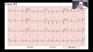 Casos clínicos  Cardiología junio 2022 parte 1 de 3 [upl. by Aivad]