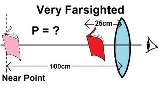 Physics  Optics Vision Correction 5 of 5 Very Farsighted [upl. by Aynos]