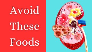 High oxalate foods  High Oxalate Foods List  Foods to avoid for kidney stones  Body Brief [upl. by Cordle]