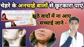 Eflornithine hydrochloride cream  eflora cream for facial hair  eflora cream how to use [upl. by Ecnal932]