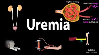 Uremia Pathophysiology Symptoms Diagnosis and Treatment Animation [upl. by Ative]