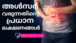 അൾസർ വന്നാൽ ശരീരം കാണിച്ചുതരുന്ന ലക്ഷണങ്ങൾ Symptoms of an Ulcer  Ethnic Health Court [upl. by Darcia271]