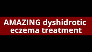 AMAZING dyshidrotic eczema treatment [upl. by Blatman879]