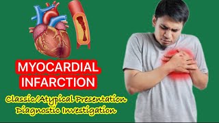 Acute Myocardial Infarction MI  ClassicAtypical Presentation  Diagnostic Investigations [upl. by Sevik]