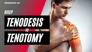 Bicep Tenodesis vs Tenotomy  Dan Orcutt MD Orthopedic Surgeon [upl. by Yablon]