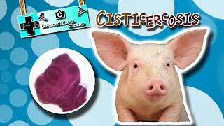 Cisticercosis ¿El consumo de carne lo ocasiona Enfermedades de los animales [upl. by Razaele]