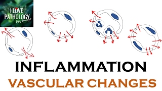 INFLAMMATION Part 1 General concepts types  Vascular changes in Acute inflammation [upl. by Soule785]