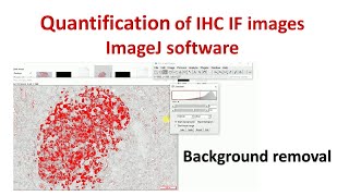 Quantification of Immunohistochemistry images using ImageJ  How to remove background in ImageJ [upl. by Celestine589]