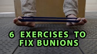 6 Exercises to Fix Bunions [upl. by Idnat363]