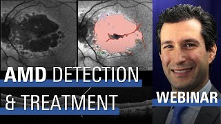 AMD The State of Detection and Treatment Options [upl. by Willdon46]