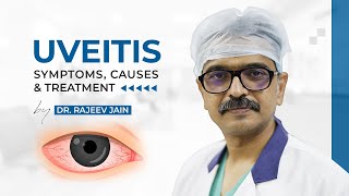 Uveitis  Causes Signs Symptoms Diagnosis amp Treatment  Dr Rajeev Jain  Delhi Best Eye Hospital [upl. by Merrily913]