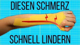 Soforthilfe mit TAPE bei Unterarmschmerzen DeQuervain Tendinitis  Test [upl. by Ttcos]