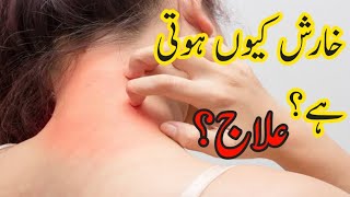 Kharish Itching Khujli Ka Fori Ilaj  allergy itching skincare [upl. by Imehon]