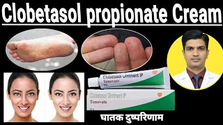 Clobetasol Cream ip tenovate  Clobetasol propionate cream [upl. by Amann]