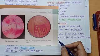 Streptococcus Pyogenes  Morphology  Virulence factors  culture amp lab diagnosis  MICROBIOLOGY [upl. by Lund523]