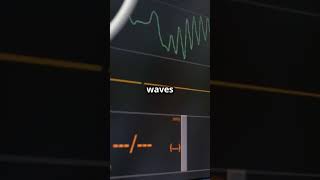 Hyperkalemia ECG Changes and Emergency Treatment medicaleducation medicalstudent DiagnosticLens [upl. by Nimajeb]