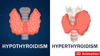 Hypothyroidism vs Hyperthyroidism Explained thyroid [upl. by Eanwahs]